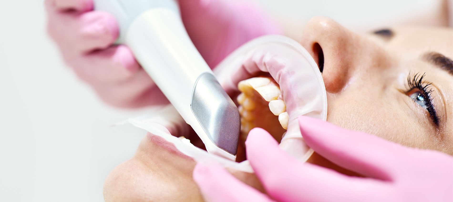 Zahnarztpraxis Dr. Christiane Langrock - Intraoralscanner 1